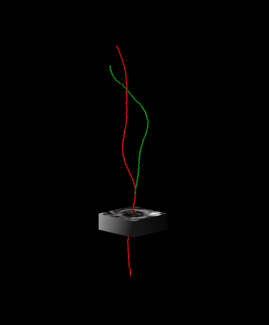 Illustration of the method